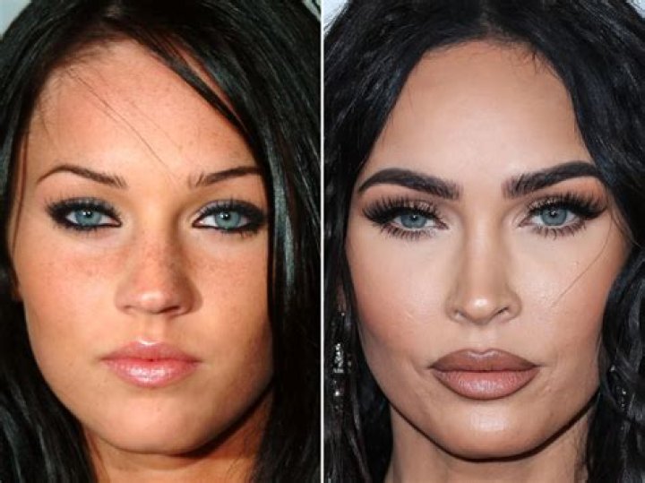 Megan Fox Plastic Surgery, Plastic Surgery Photos, Celebrity Plastic