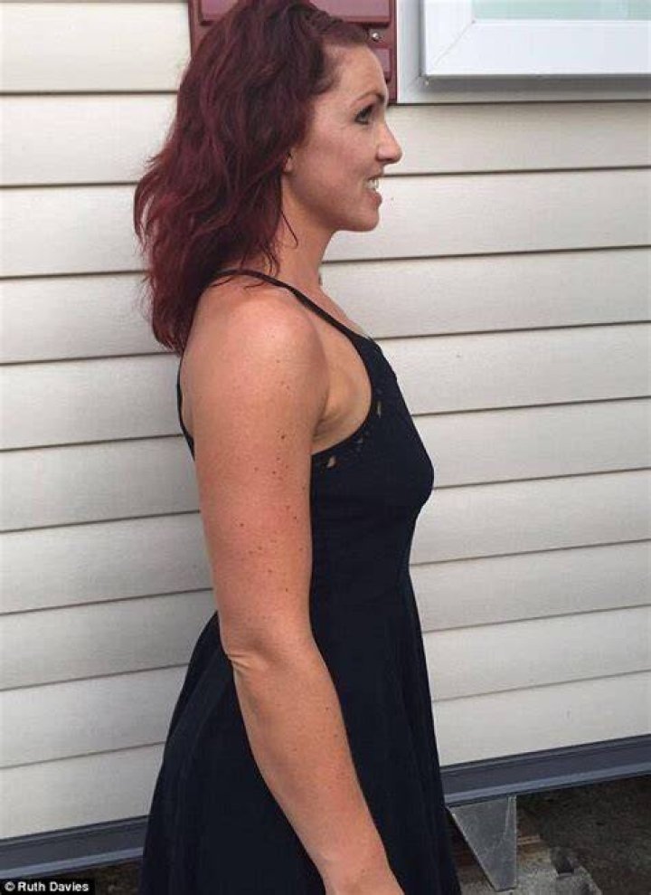 Mother whose breasts went from an F cup to a 'saggy' B after she shed