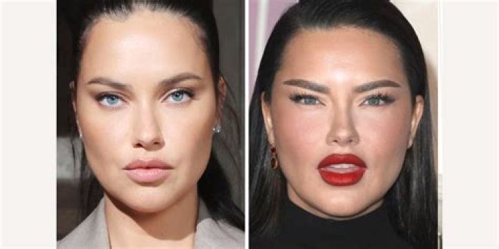New Mom Adriana Lima Responds To Criticism Over Her Face Motherly