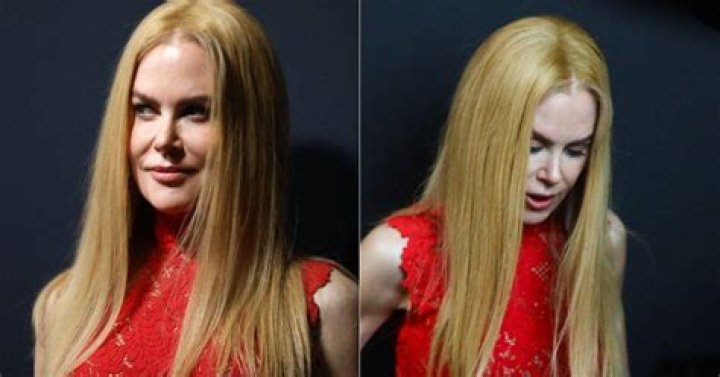 Nicole Kidman Breast Augmentation Truth Revealed