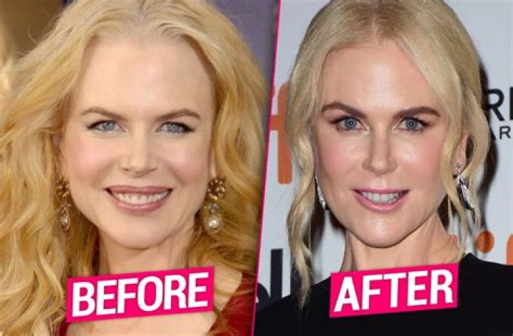 Nicole s nip tuck nightmare plastic surgeons blame facelift fillers