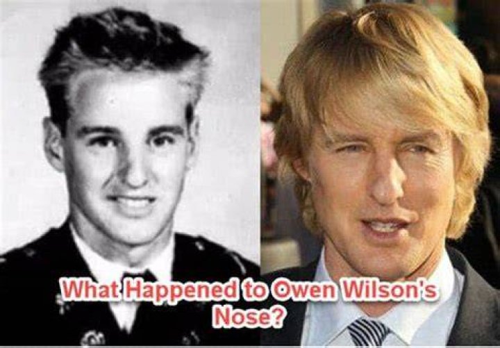Owen Wilson Broke His Nose 'Roughhousing' at Least Twice