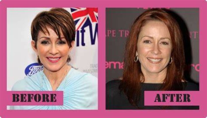 Patricia Heaton Cosmetic Surgery: Before And After Transformations