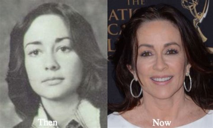 Patricia Heaton Plastic Surgery Before After Breast I vrogue.co
