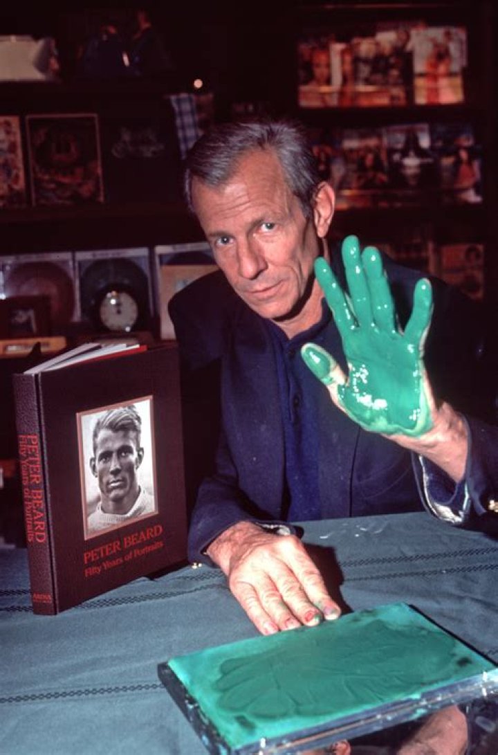 Photographer Peter Beard Romanced Lee Radziwill and Partied with the