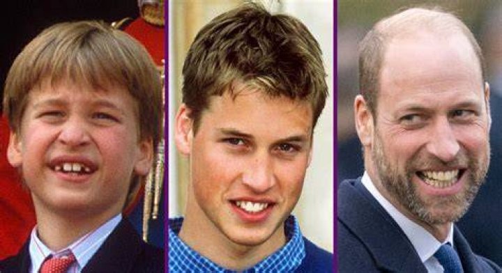 Prince William With Hair &mdash; Check out These Throwback Pics of the