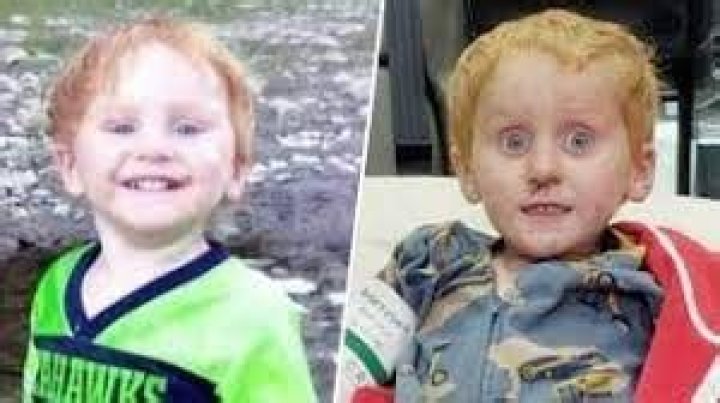 Ryker Webb Now Before And After of Ryker Webb Ratio Buzz