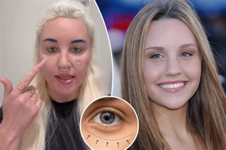 Sabeina Carpenter's Cosmetic Surgery Journey: An In-Depth Look