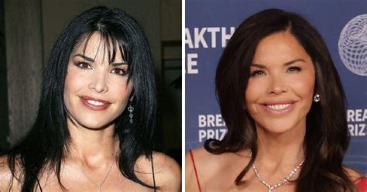 Sabrina's Plastic Surgery Transformation: Before And After Photos.