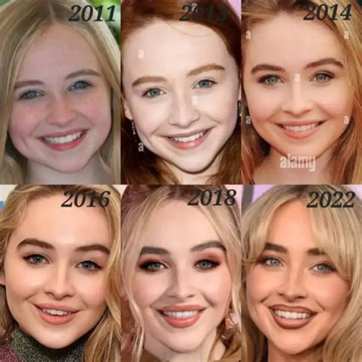 Sabrina Carpenter's Facial Transformation: The Evolution Of Her Beauty