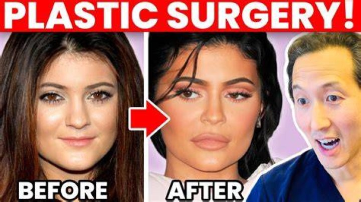 Sabrina Carpenter's Transformation: The Truth About Her Plastic Surgery