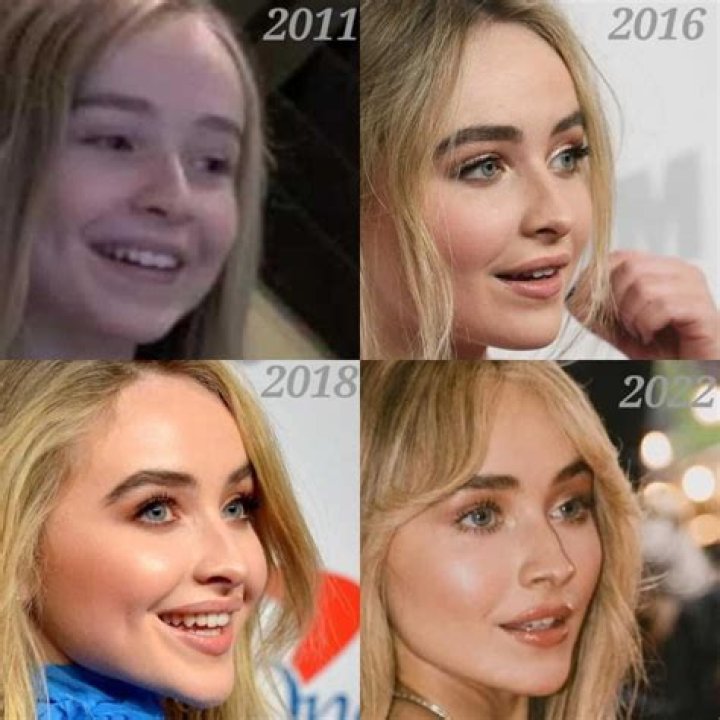 Sabrina Carpenter Nose Surgery: Transformation And Controversy