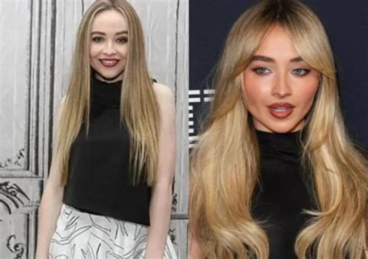 Sabrina Carpenter Plastic Surgery Did She Have Any Cosmetic Enhancements?