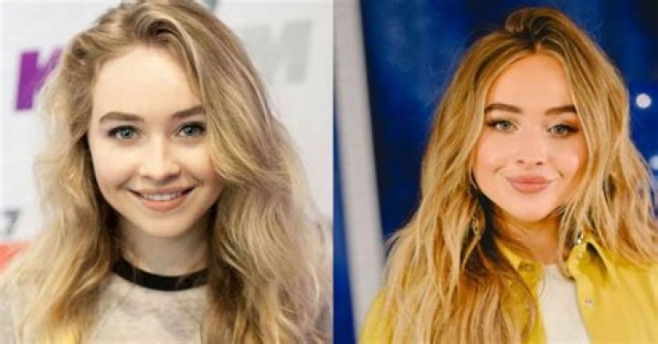 Sabrina Carpenter Plastic Surgery The Secret of Her DollLike Appearance!