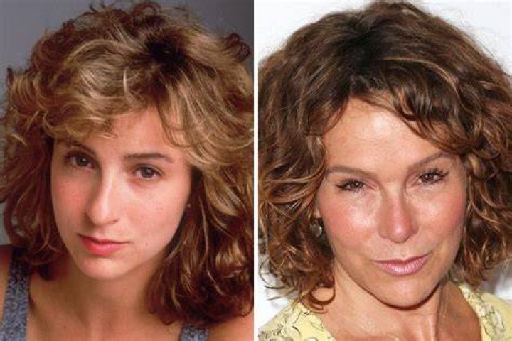 See Jennifer Grey Before and After Plastic Surgery!