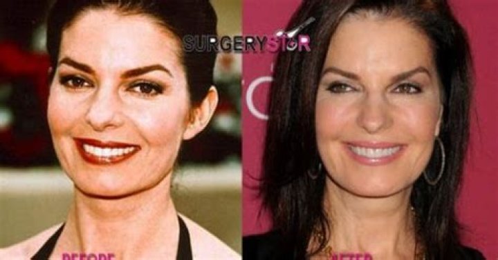 Sela Ward Plastic Surgery Before and After Pictures 2024