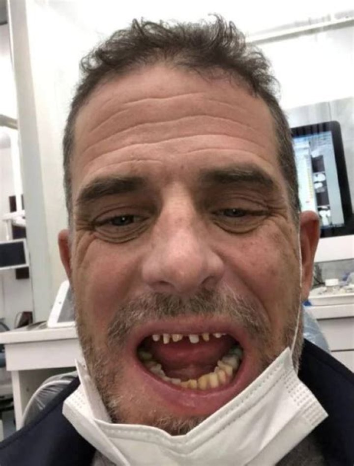 Shocking photos of Hunter Biden's crack addict teeth NZ Herald