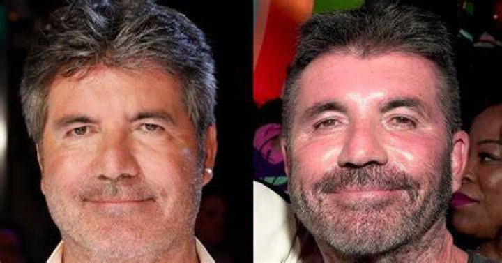 Simon Cowell Removes His Face Fillers After Saying He Went &ldquo;Too Far&rdquo;