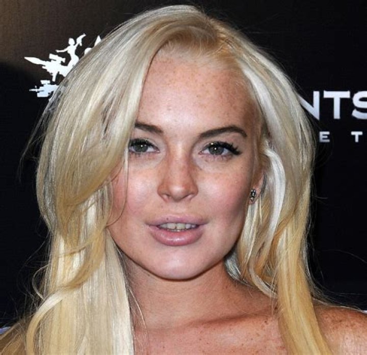 That Bites! Lindsay Lohan's Teeth Look Rotted Again &mdash; Is She OK?