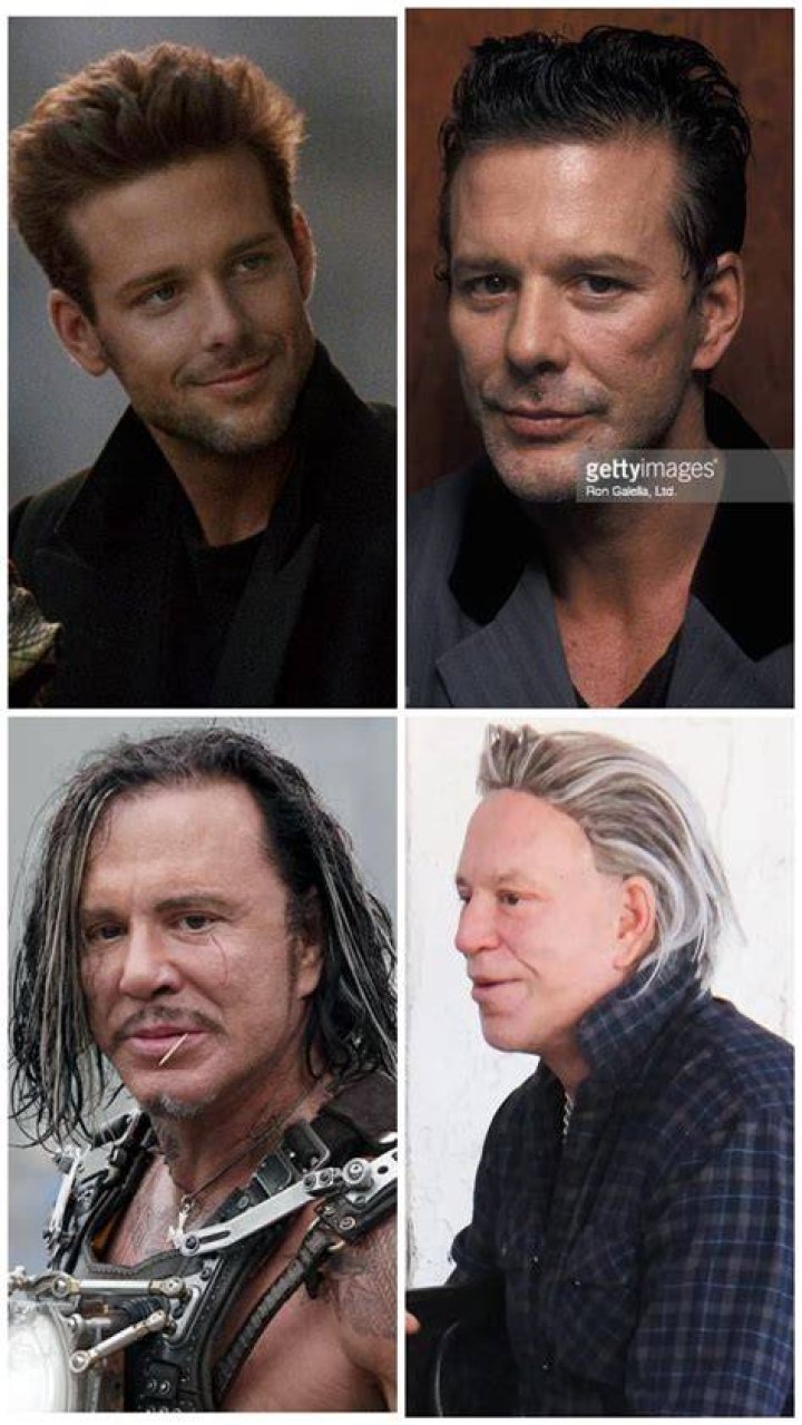 The Evolution Of Mickey Rourke Before And After Plastic Surgery 