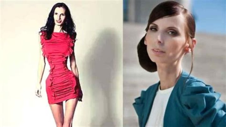 The Skinniest Model In The World: Beauty Or Controversy?