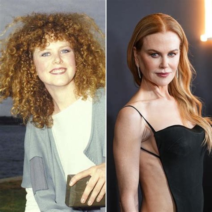 The Truth About Nicole Kidman's Breast Surgery: Unveiling The Facts