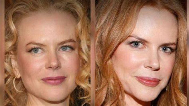 The Truth About Nicole Kidman's Nose Job: Before And After Transformation