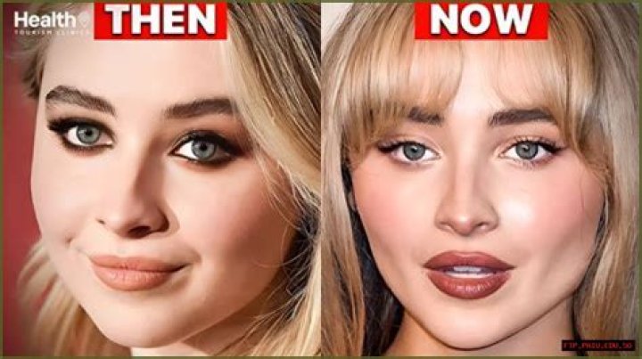 The Truth About Sabrina Carpenter's Plastic Surgery Rumors
