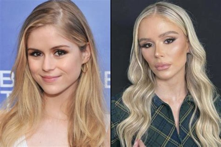 The Truth About Sabrina Carpenter's Plastic Surgery Speculations