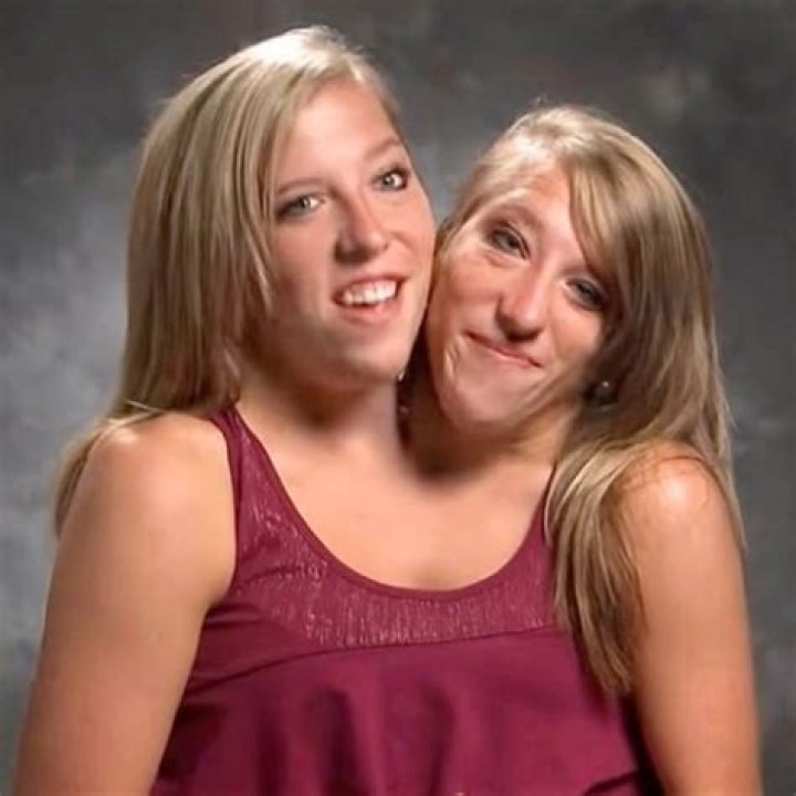 THE TWINS Twins, Dream, Face, The Face, Gemini, Faces, Twin, Facial
