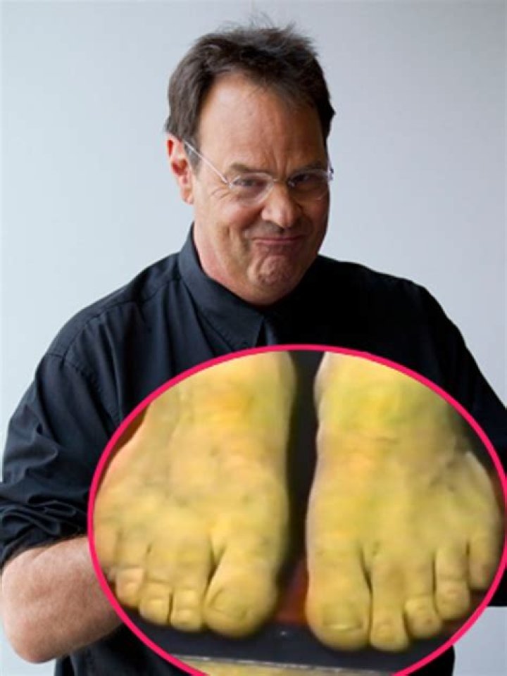 The Weirdest Physical Defects Celebrities Have