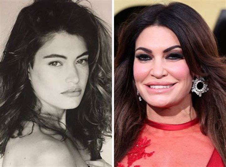 Transformation Journey: Kimberley Guilfoyle Before And After