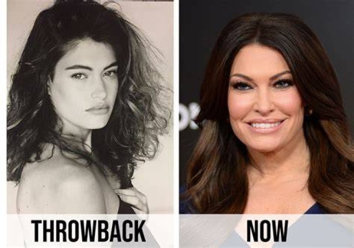 Transformative Journey: A Look At Before And After Pictures Of Kimberly Guilfoyle
