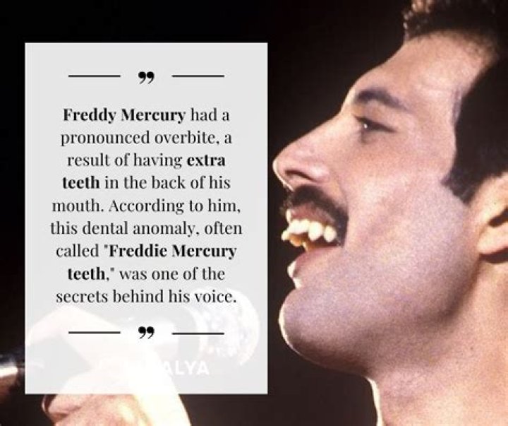 Uncovering The Truth: Did Freddie Mercury Have A Child?