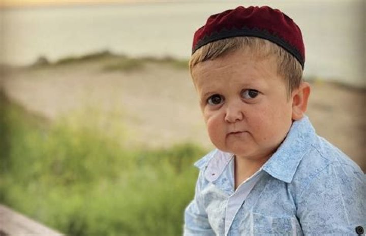 Understanding Hasbulla Syndrome: A Unique Phenomenon