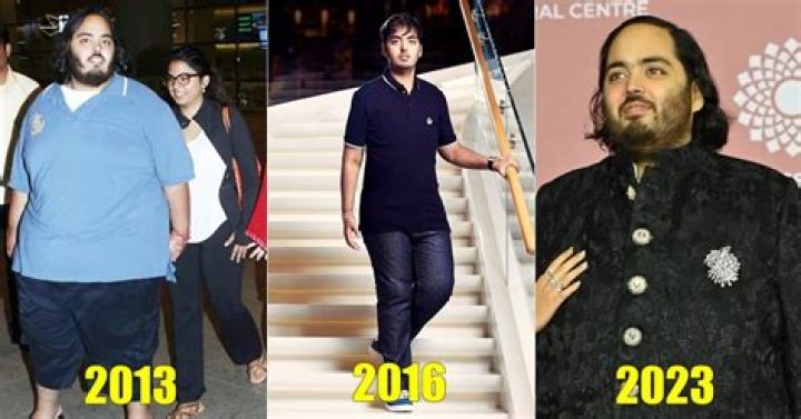 Unraveling The Health Mystery: What Disease Anant Ambani Is Having?