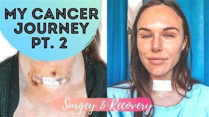 Unraveling The Journey Of Joyce Vance's Thyroid Surgery