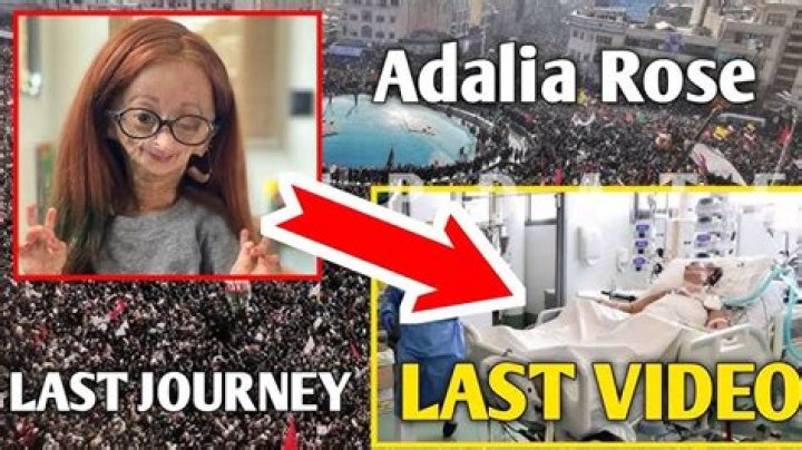 Unraveling The Mystery: Did Adalia Rose Die?