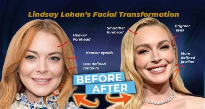 Unraveling The Mystery: Does Lindsay Lohan Have A Twin?