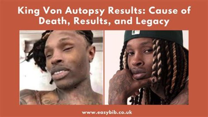 Unraveling The Mystery: King Von Autopsy Cause Of Death