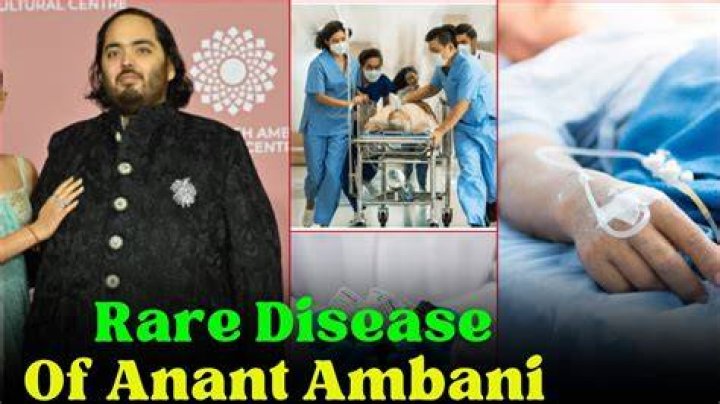 Unraveling The Mystery: What Disease Anant Has?