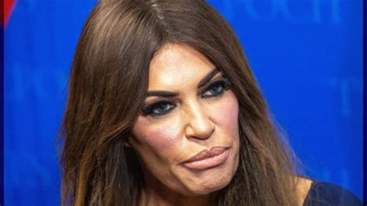 Unveiling The Allure Of Kim Guilfoyle's Face