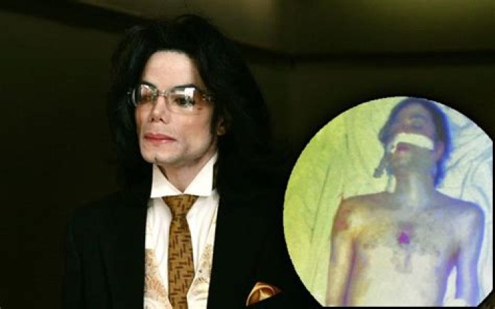 Unveiling The Mystery: Michael Jackson Autopsy Photos