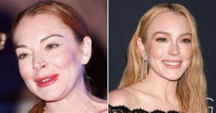 Unveiling The Secrets Behind Lindsay Lohan's Teeth