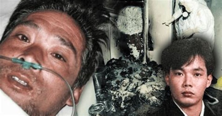 Unveiling The Tragic Story Of Hisashi Ouchi: A Visual Chronicle Of Survival