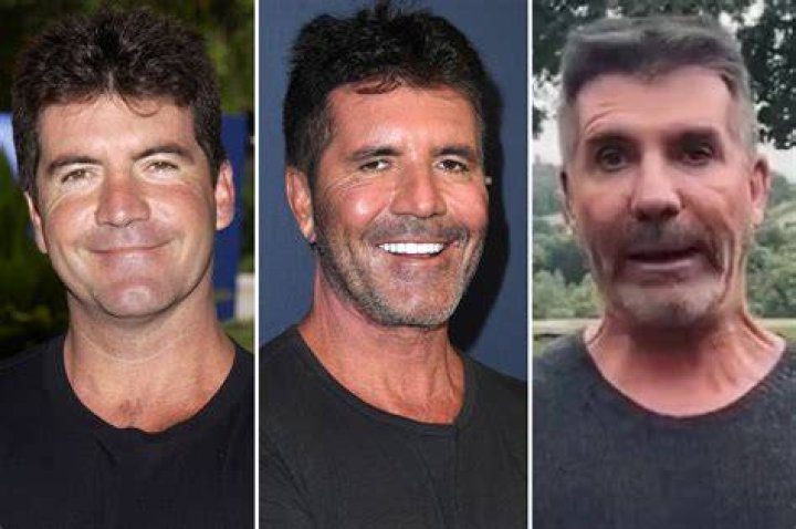 Unveiling The Transformation: Simon Cowell's Pre-Botox Era