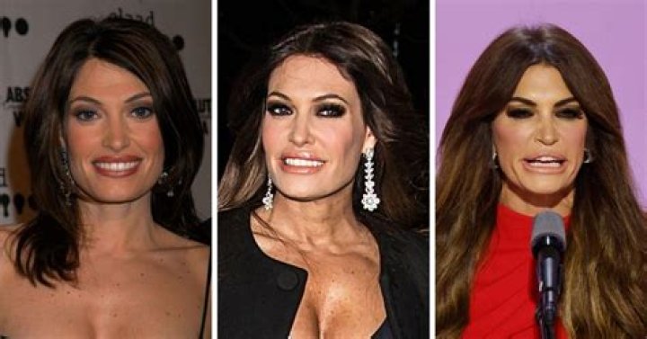 Unveiling The Truth Behind Kimberley Guilfoyle's Plastic Surgery Journey