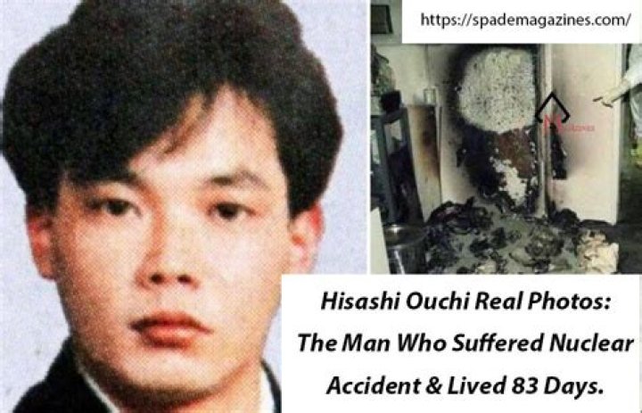 Unveiling The Truth: Hisashi Ouchi Real Photos And Body Photos
