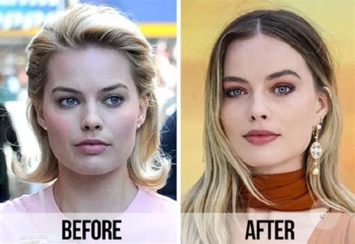 Unveiling The Truth: Margot Robbie's Nose Job Rumors