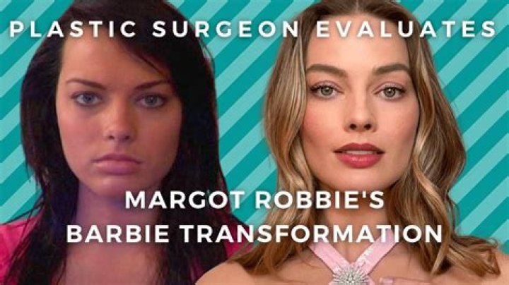 Unveiling The Truth: Margot Robbie And Plastic Surgery
